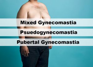 types of gynecomastia