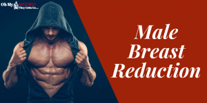 male breast reduction treatment